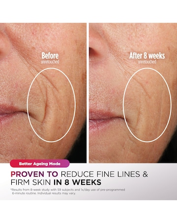 Shark Cryoglow Under-Eye Cooling + Led Anti-Ageing & Blemish Repair Mask - Sage